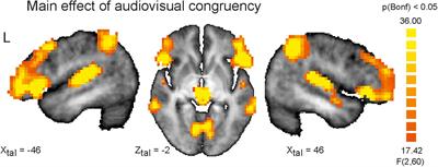 Auditory Deficits in Audiovisual Speech Perception in Adult Asperger’s Syndrome: fMRI Study